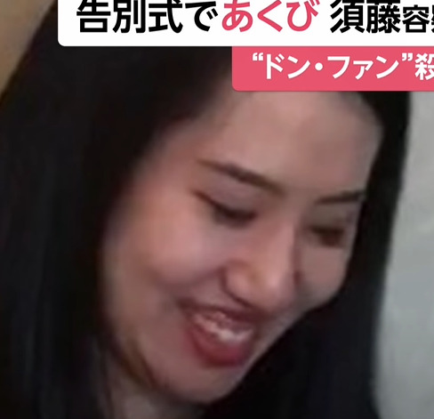 歯茎(ガミースマイル)