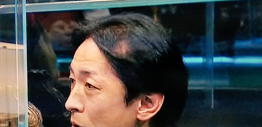 矢部浩之薄毛