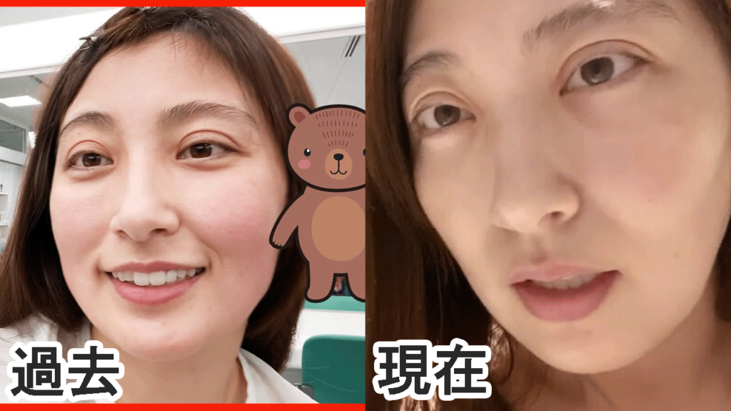 熊田曜子画像比較2
