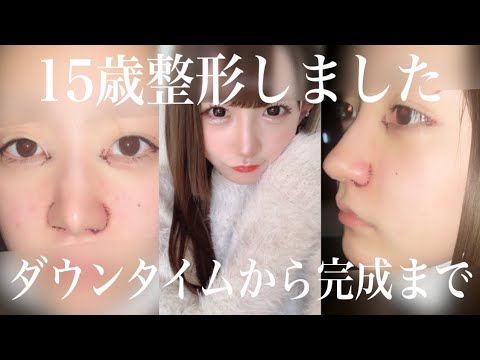 こはくぶちょー整形①